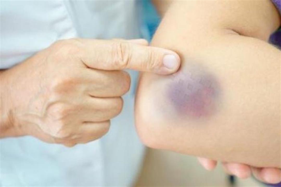 أعراض الجلطة القلبية قبل حدوثها