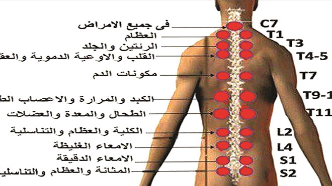 أسرار الحجامة