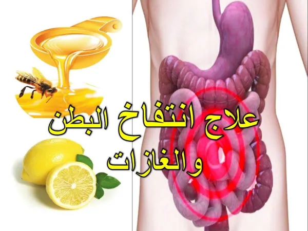 علاج انتفاخ البطن والغازات