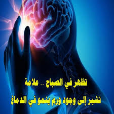 علامة تظهر في الصباح تشير إلى وجود ورم في الدماغ