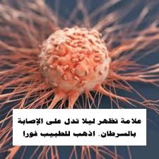 علامة تظهر ليلا تدل على الاصابة بالسرطان