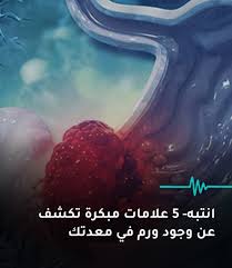 علامات مبكرة تكشف عن وجود ورم في معدتك